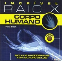 Incrível Raio-X - Corpo Humano 
